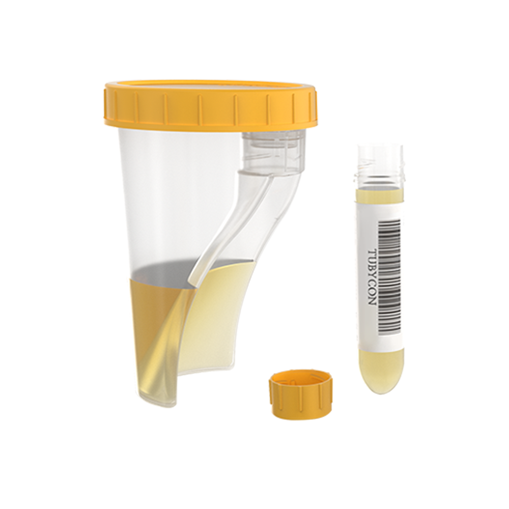 TUBYCON Single Tube Urine Test Cup Kit